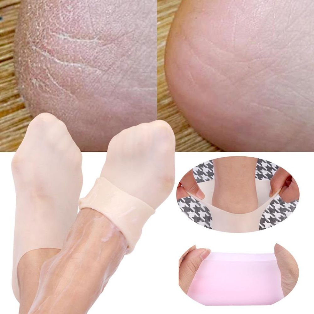 SoftStep™ hámlasztó zokni, 2 darabos szett (univerzális méret)