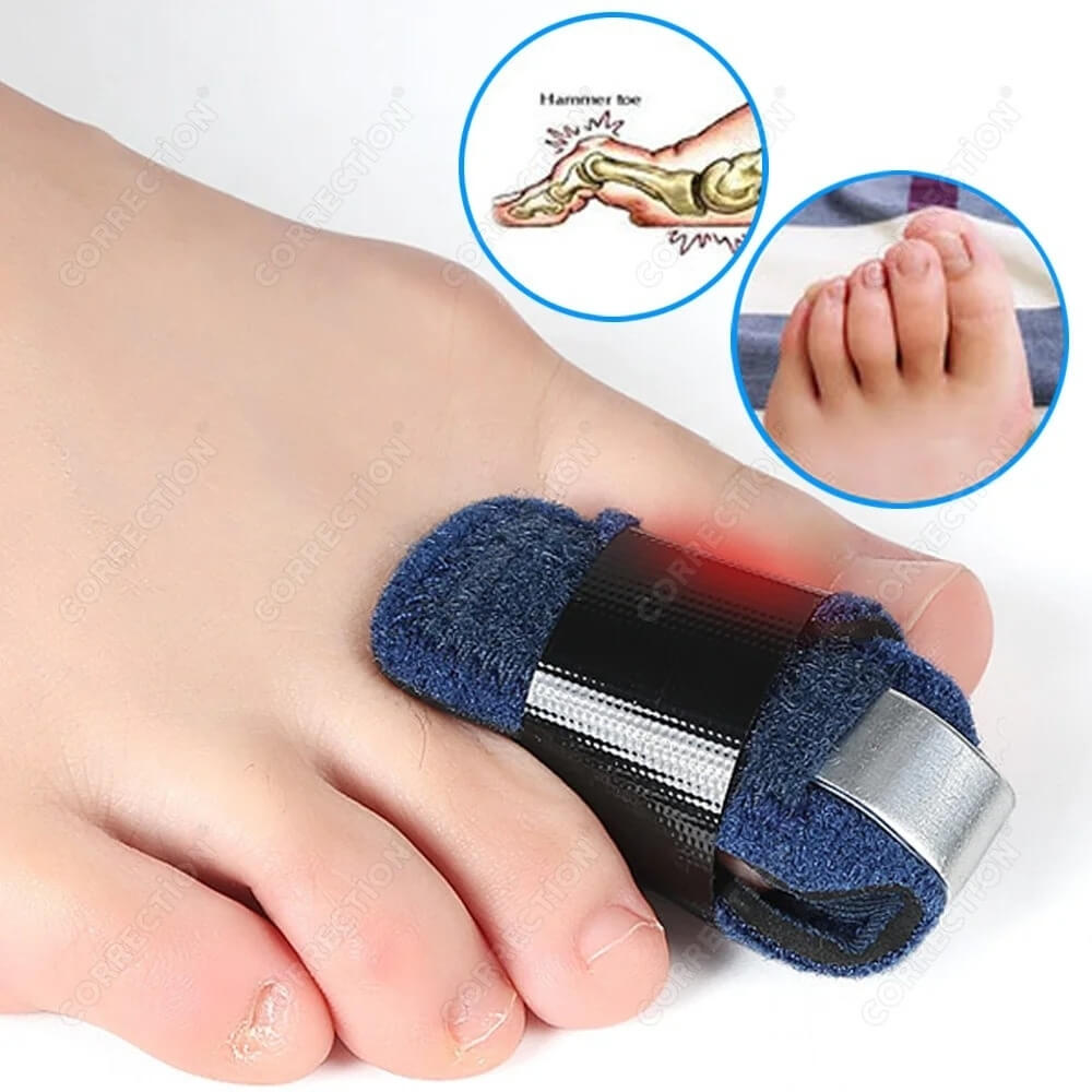 ToeRelief™ – Ortopéd lábujjkorrektor egymásra csúszó és kalapácsujjakhoz